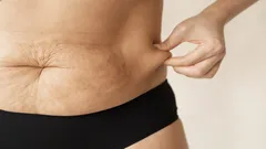 A barriga depois dos 50 anos não desaparece sozinha — como ativar o modo oculto de queimar gordura